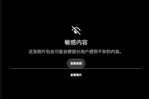 惊悚！慎入！范德彪小拇指骨头暴露无遗！
