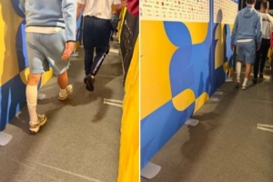 赖斯赛后跛行经过混合采访区，左小腿绑着绷带